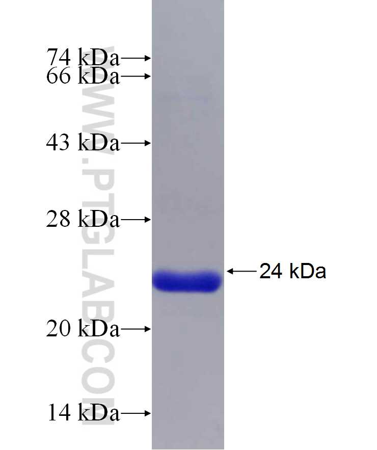TRAF4 fusion protein Ag29685 SDS-PAGE TRAF4 fusion protein Ag29685 SDS-PAGE