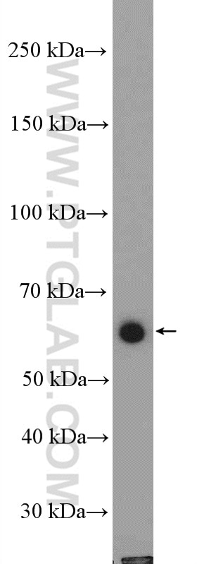 Western Blot (WB) analysis of HeLa cells using TRAF5 Polyclonal antibody (12868-1-AP)