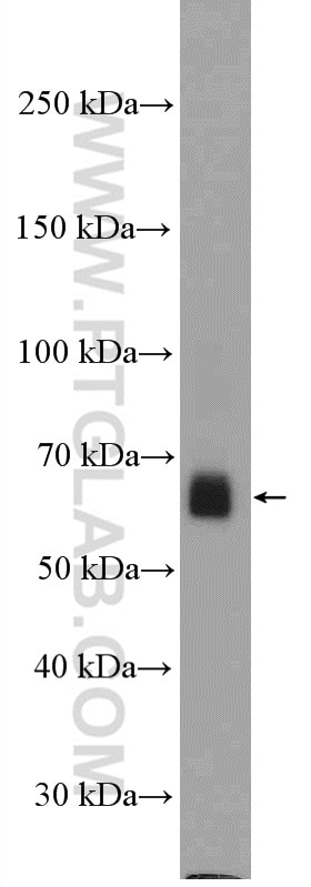 Western Blot (WB) analysis of PC-3 cells using TRAF5 Polyclonal antibody (12868-1-AP)