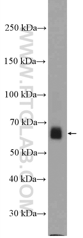 WB analysis of PC-3 using 12868-1-AP