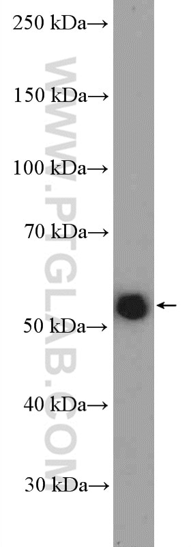 Western Blot (WB) analysis of Jurkat cells using TRAF5 Polyclonal antibody (12868-1-AP)