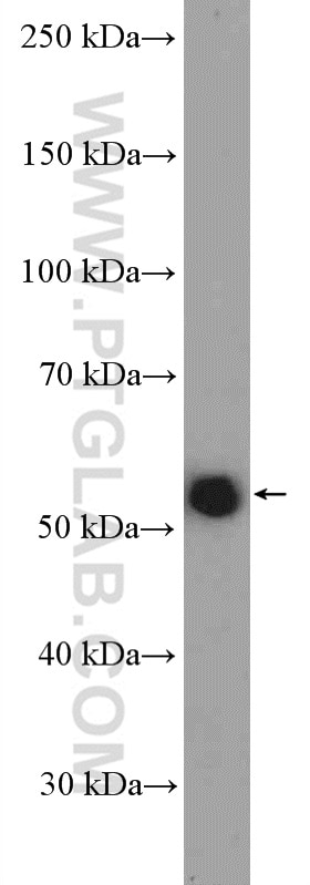 WB analysis of Jurkat using 12868-1-AP