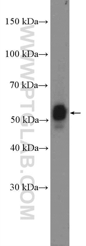 TRAF5 Polyclonal antibody