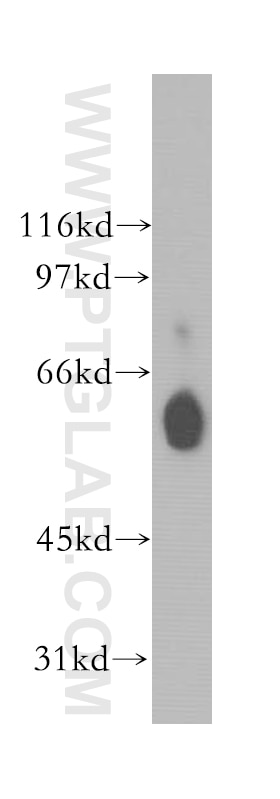 Western Blot (WB) analysis of mouse pancreas tissue using TRAF5 Polyclonal antibody (12868-1-AP)