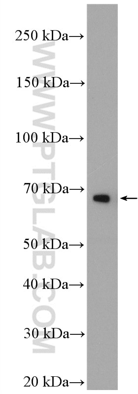 Western Blot (WB) analysis of Jurkat cells using TRAF5 Polyclonal antibody (26917-1-AP)