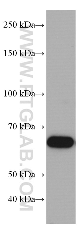 Western Blot (WB) analysis of HeLa cells using TRAF5 Monoclonal antibody (66991-1-Ig)