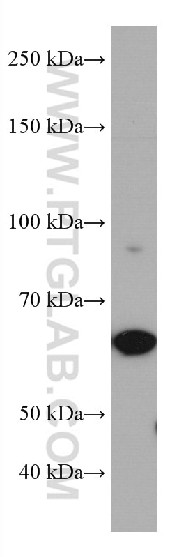 Western Blot (WB) analysis of LNCaP cells using TRAF5 Monoclonal antibody (66991-1-Ig)