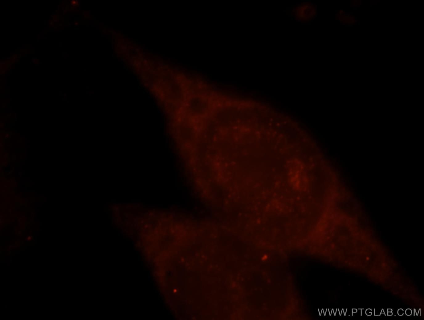 TRAF6 Polyclonal antibody