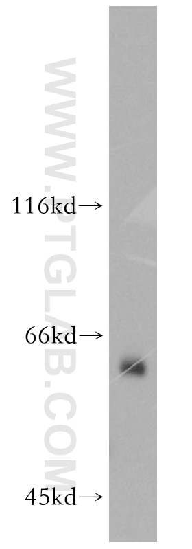 TRAF6 Polyclonal antibody