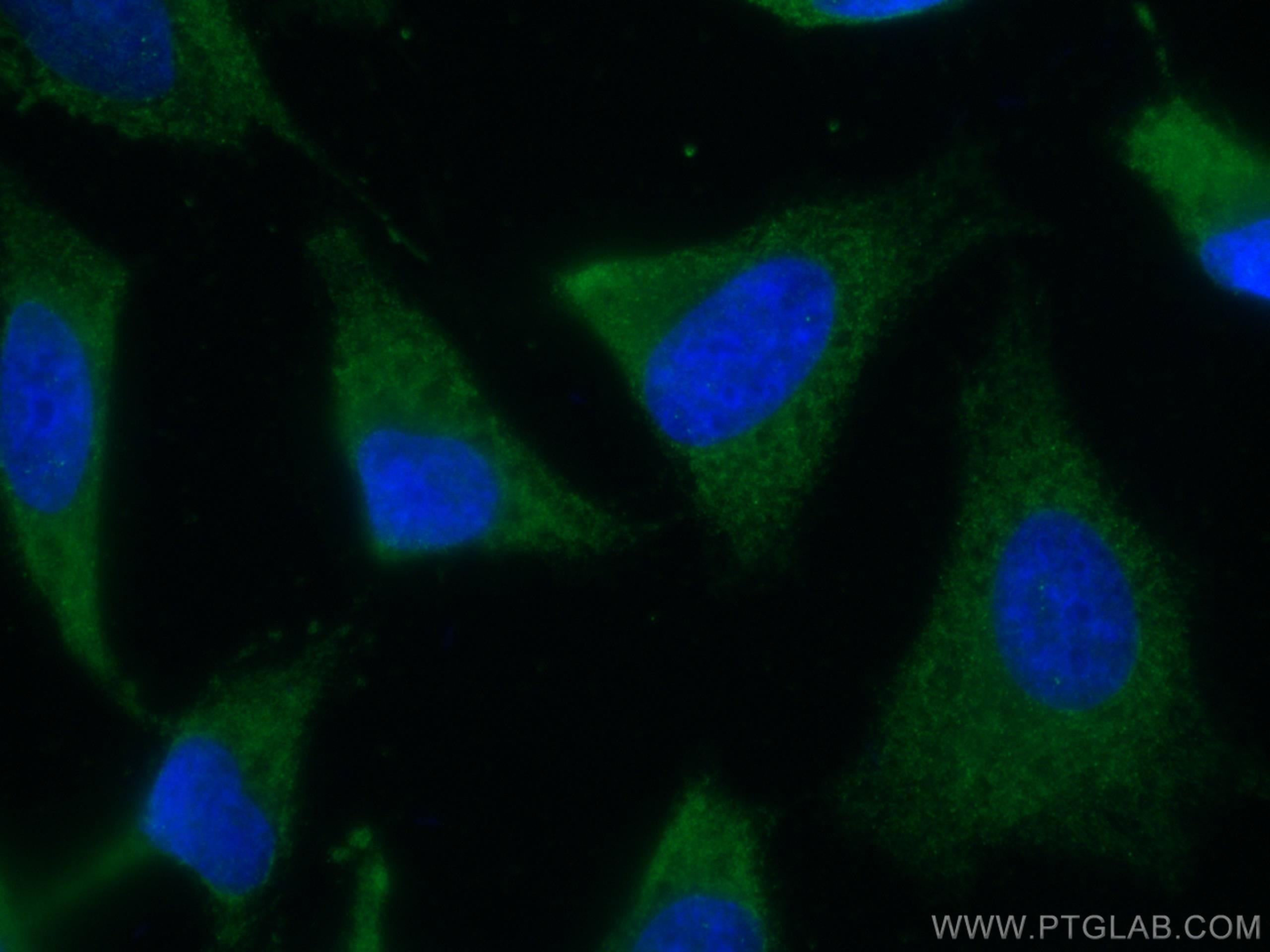 Immunofluorescence (IF) / fluorescent staining of HeLa cells using TRAF6 Monoclonal antibody (66498-1-Ig)