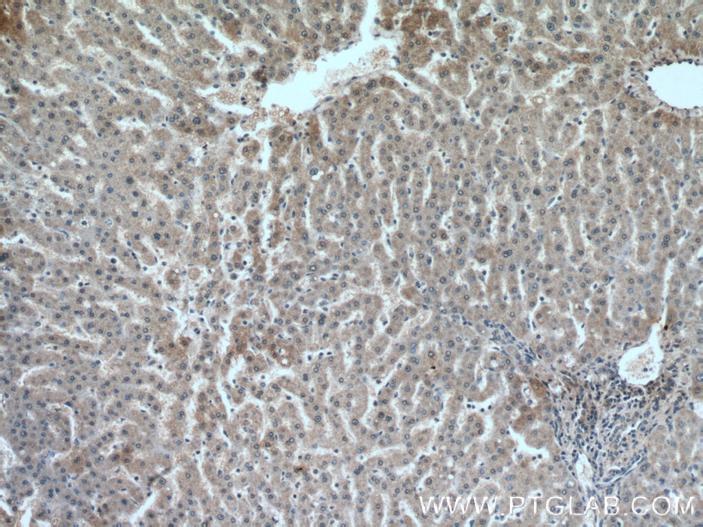 Immunohistochemistry (IHC) staining of human liver tissue using TRAF6 Monoclonal antibody (66498-1-Ig)