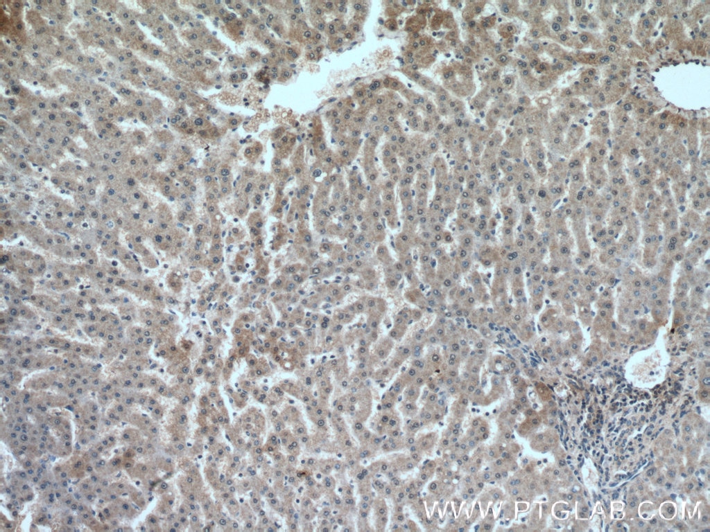 IHC staining of human liver using 66498-1-Ig