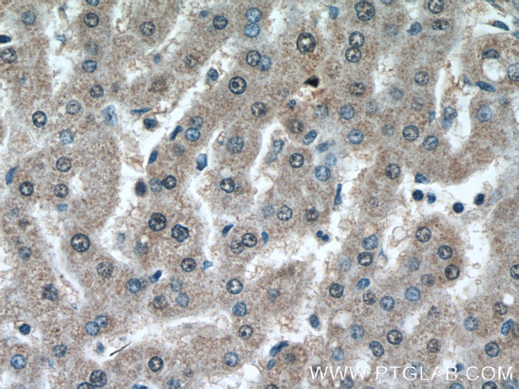 IHC staining of human liver using 66498-1-Ig