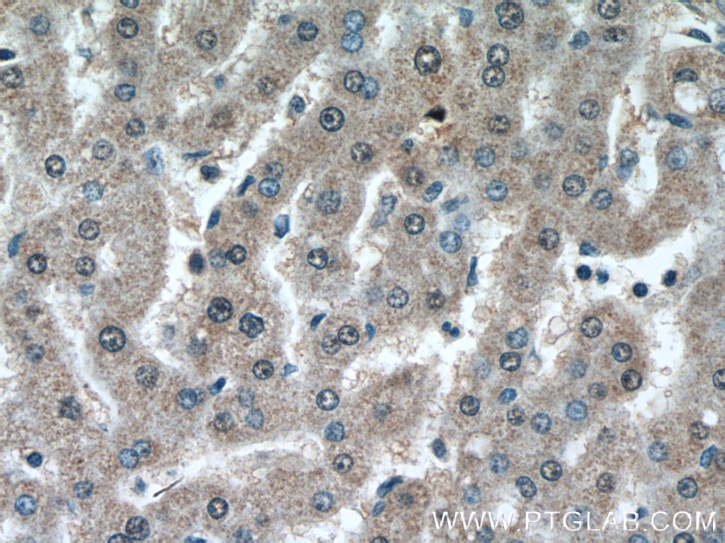 Immunohistochemistry (IHC) staining of human liver tissue using TRAF6 Monoclonal antibody (66498-1-Ig)