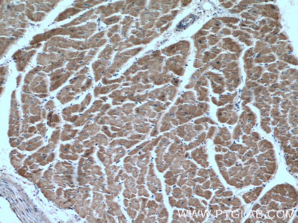 Immunohistochemistry (IHC) staining of human heart tissue using TRAF6 Monoclonal antibody (66498-1-Ig)