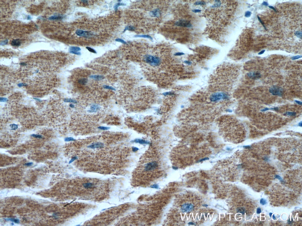 Immunohistochemistry (IHC) staining of human heart tissue using TRAF6 Monoclonal antibody (66498-1-Ig)
