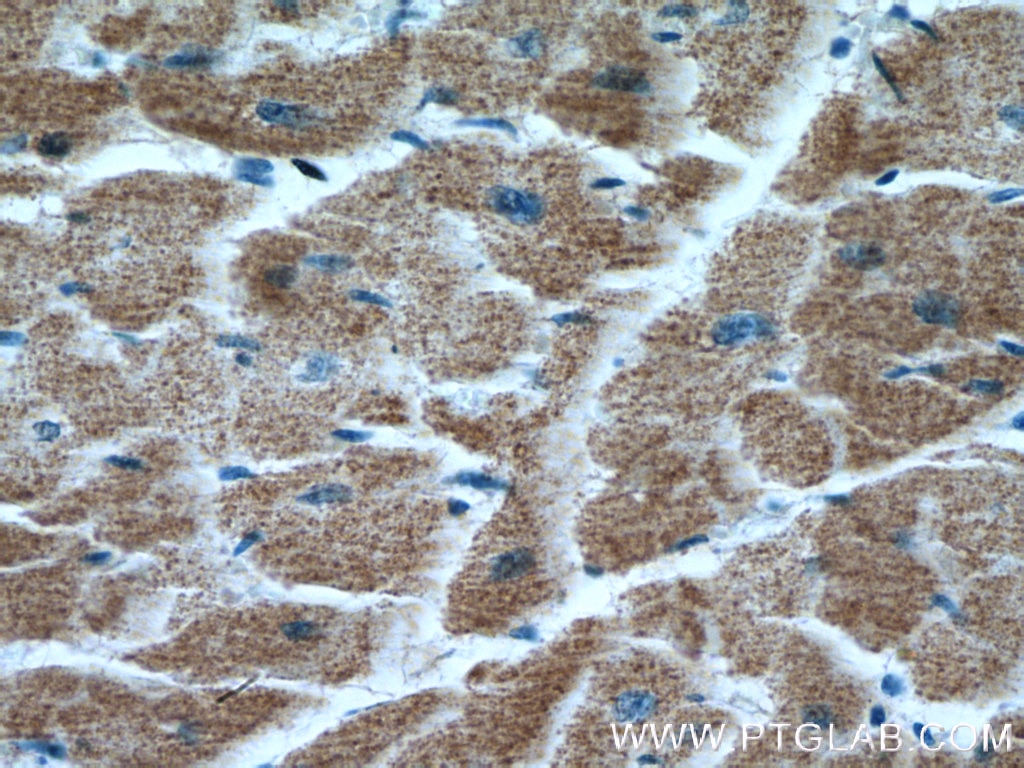 IHC staining of human heart using 66498-1-Ig