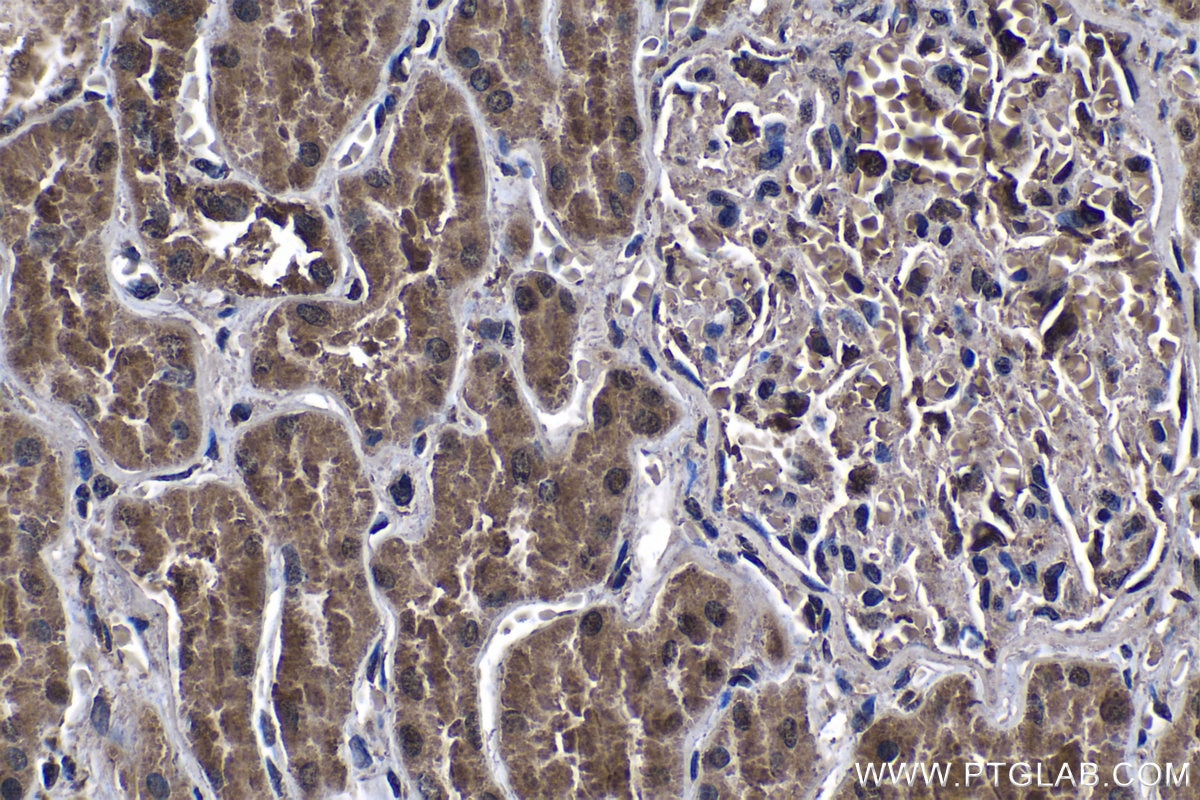 IHC staining of human kidney using 66498-1-Ig Immunohistochemistry (IHC) staining of human kidney tissue using TRAF6 Monoclonal antibody (66498-1-Ig)