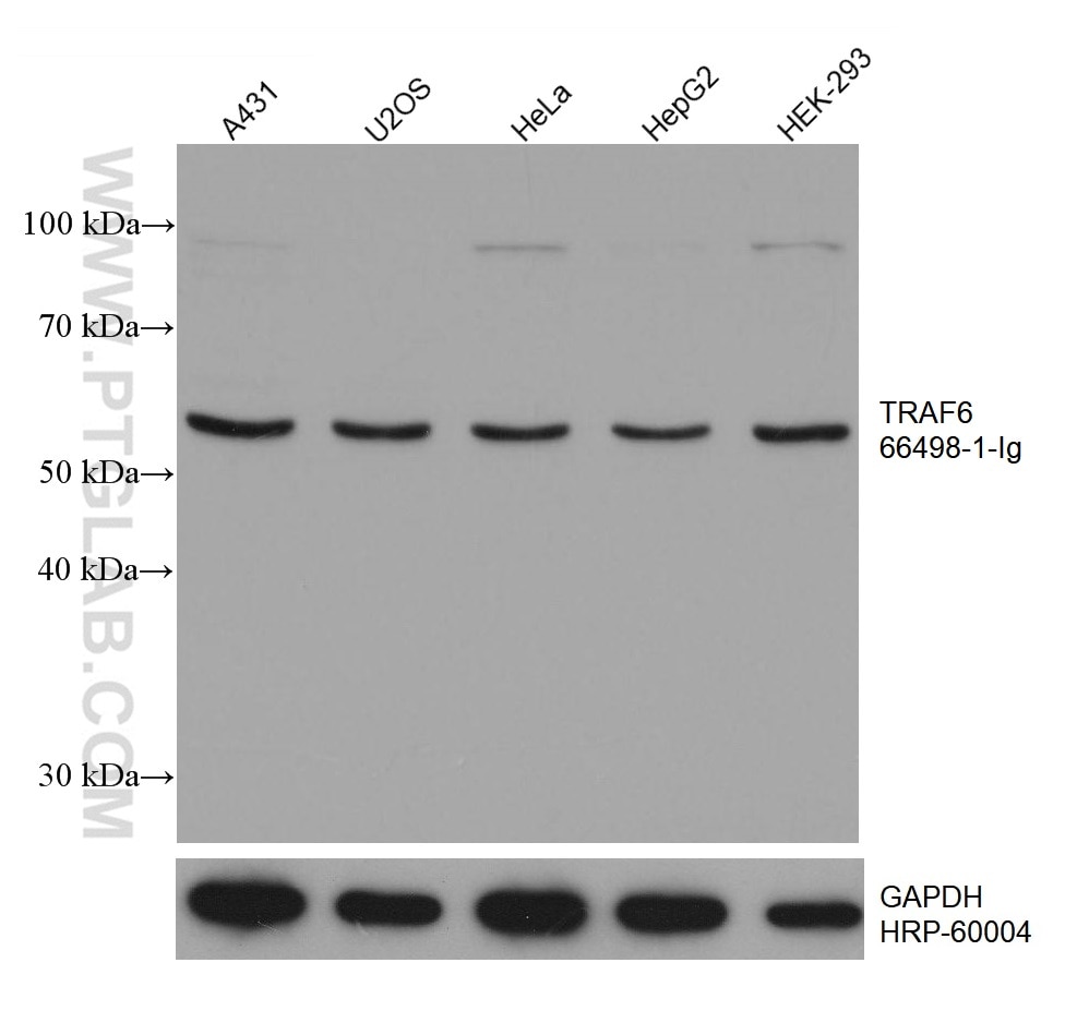 Western Blot (WB) analysis of various lysates using TRAF6 Monoclonal antibody (66498-1-Ig)