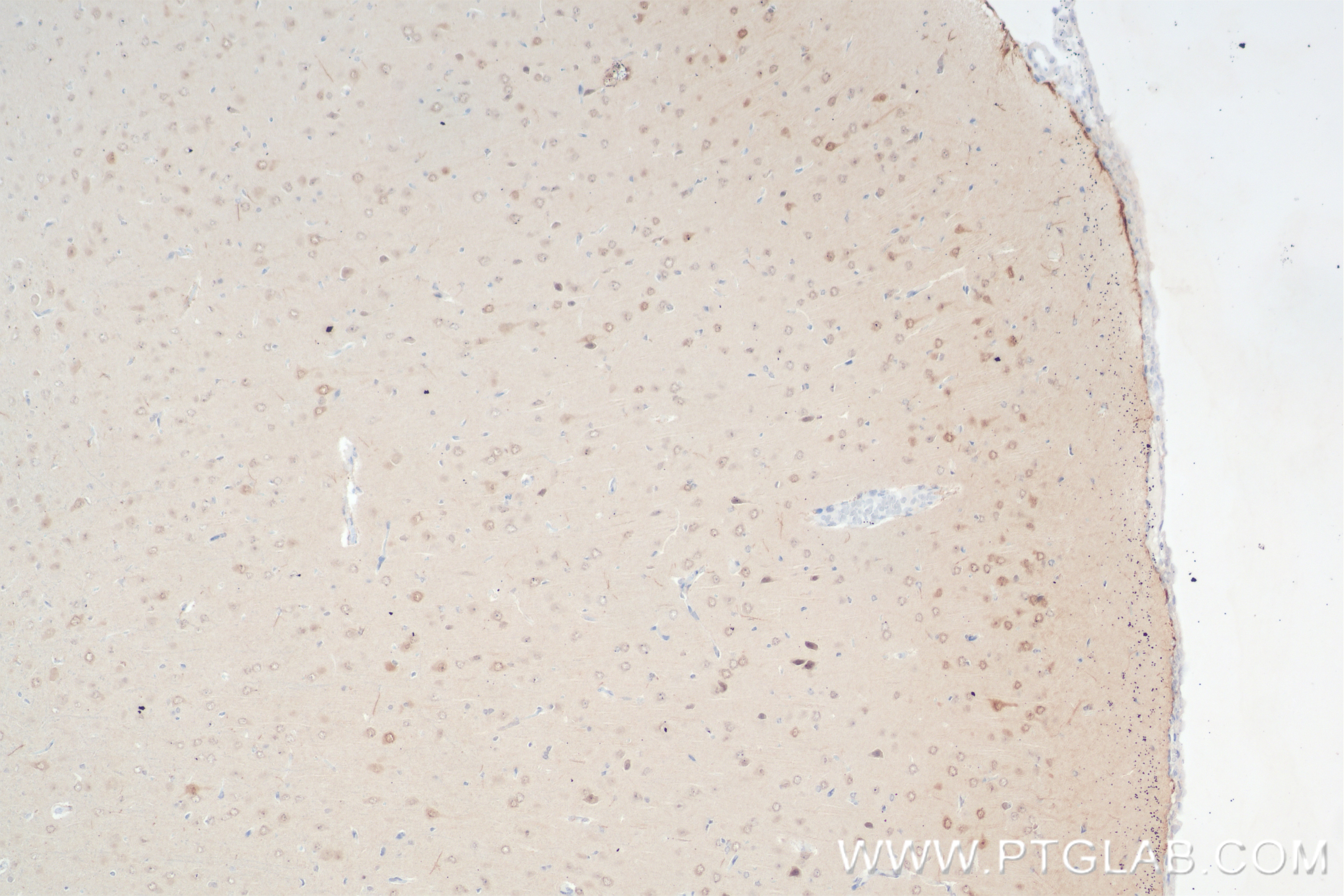 Immunohistochemistry (IHC) staining of rat brain tissue using TRAF6 Recombinant antibody (83535-2-RR)