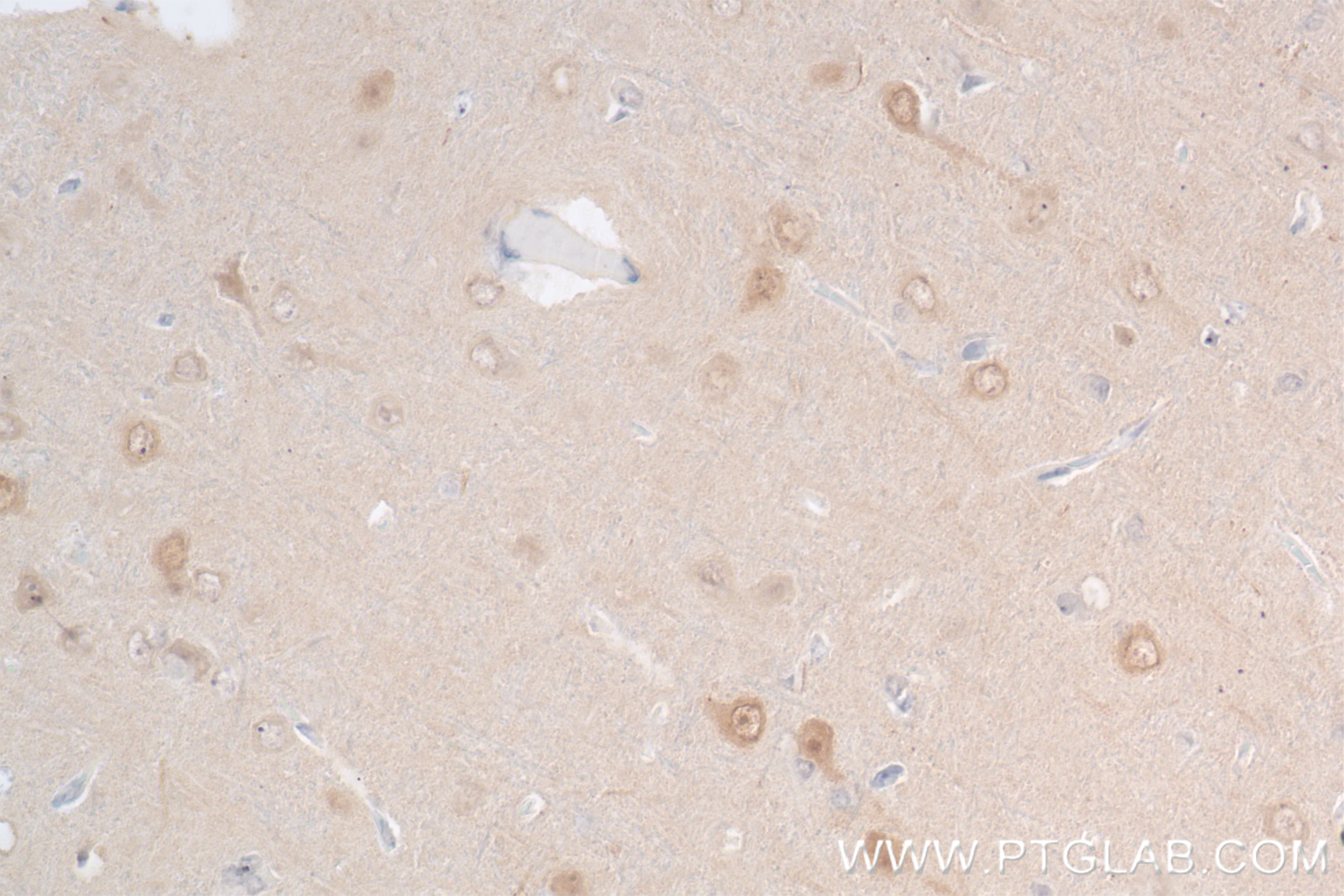 Immunohistochemistry (IHC) staining of rat brain tissue using TRAF6 Recombinant antibody (83535-2-RR)