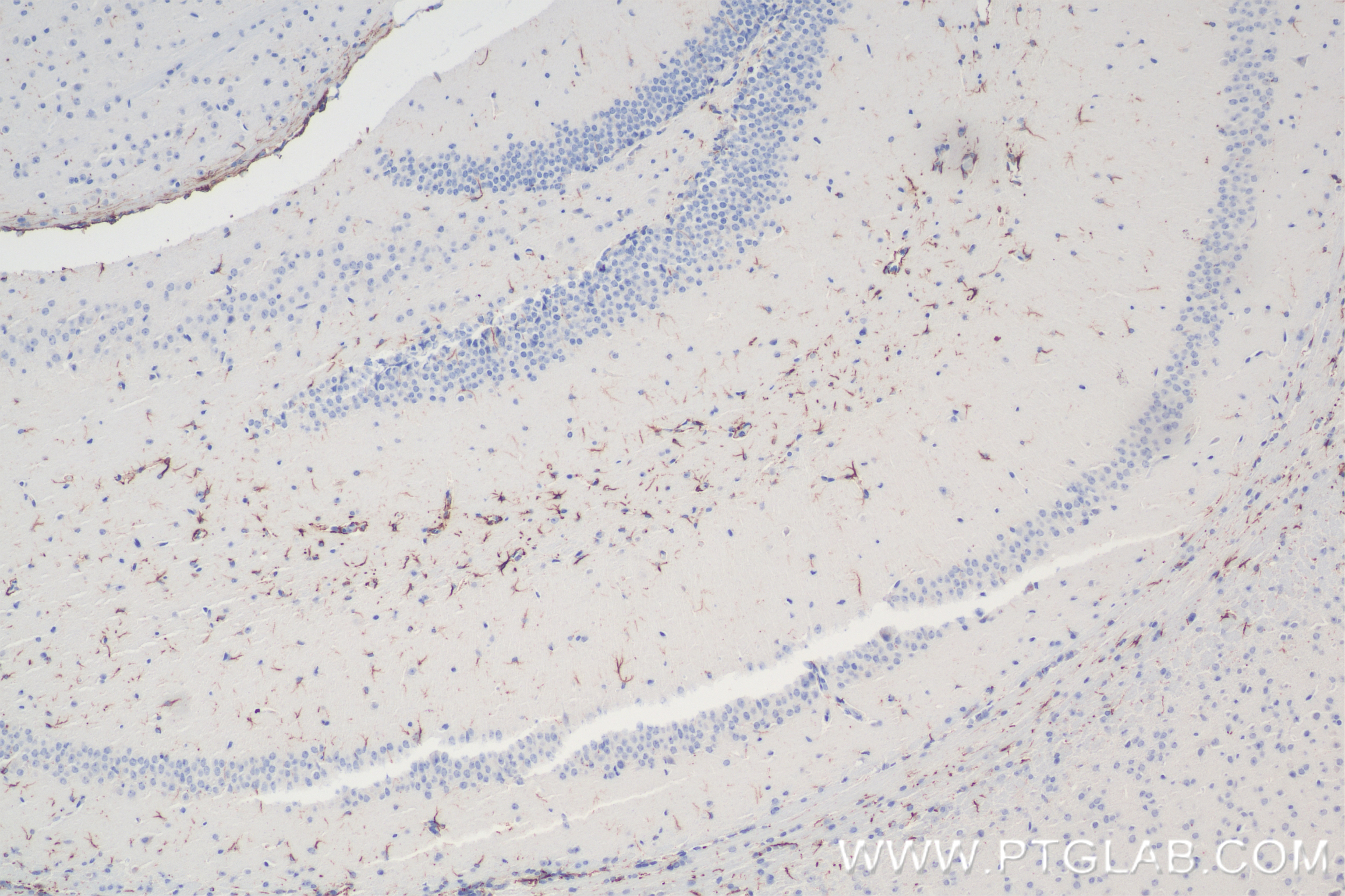 Immunohistochemistry (IHC) staining of mouse brain tissue using TRAF6 Recombinant antibody (83535-2-RR)