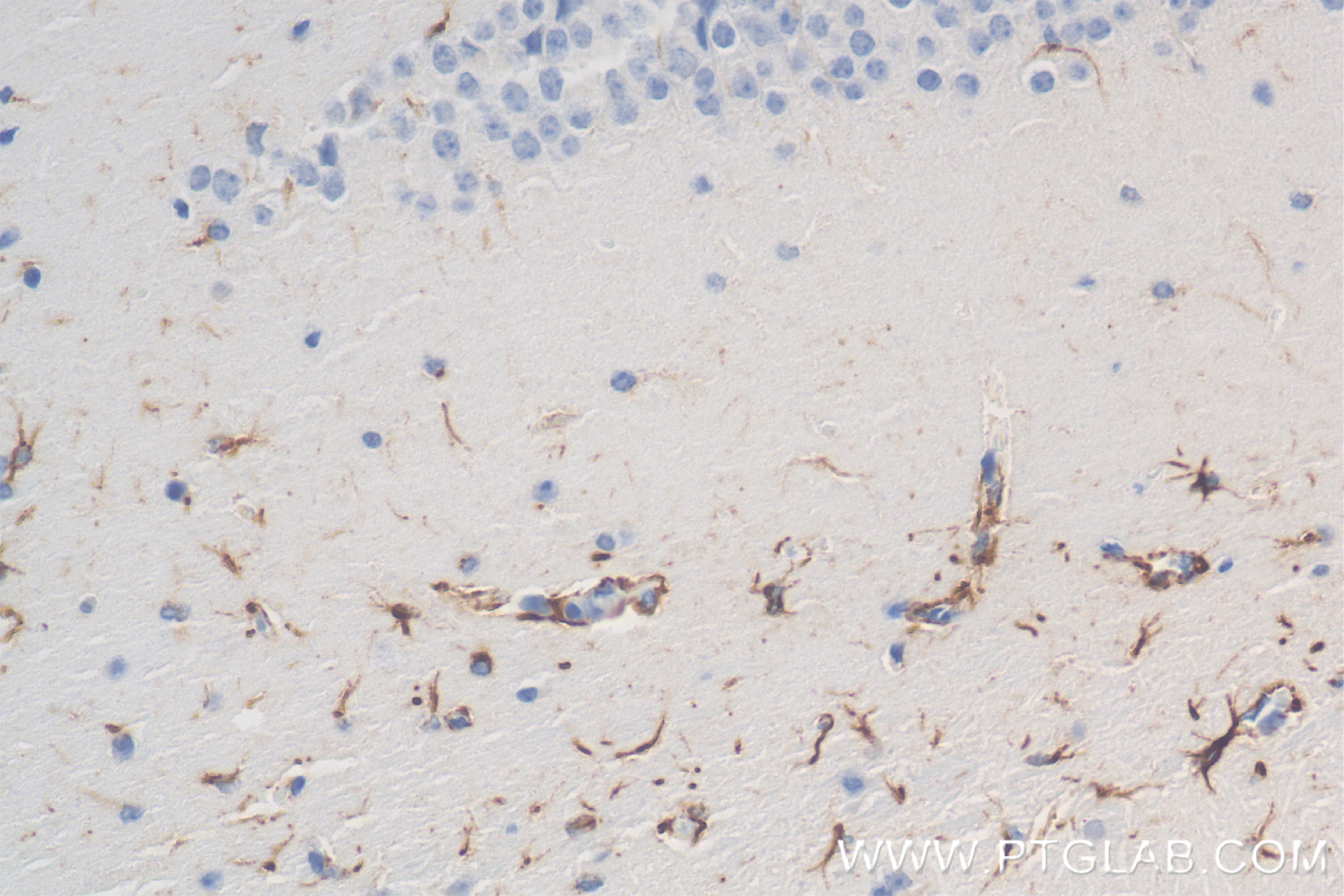 Immunohistochemistry (IHC) staining of mouse brain tissue using TRAF6 Recombinant antibody (83535-2-RR)