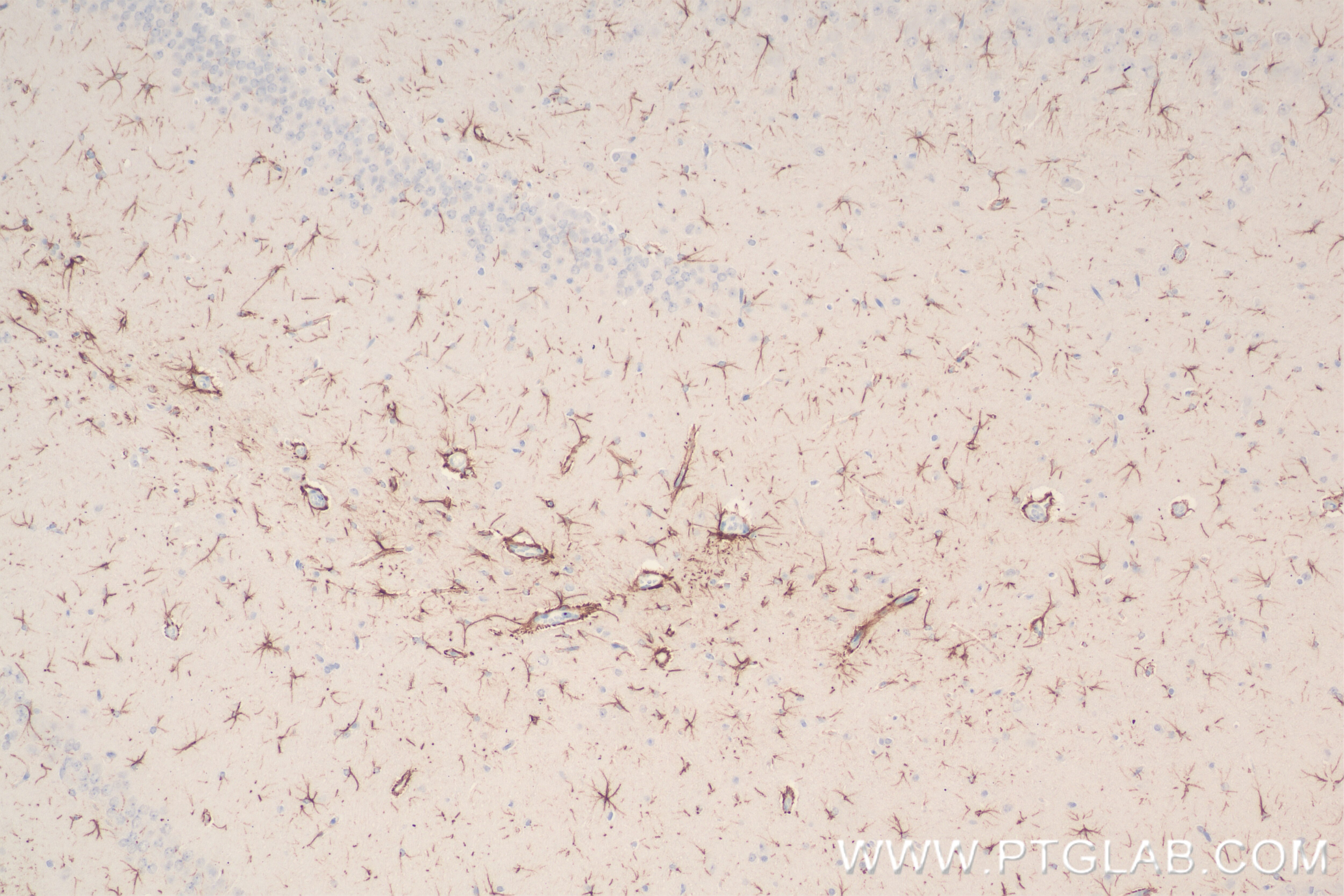 Immunohistochemistry (IHC) staining of rat brain tissue using TRAF6 Recombinant antibody (83535-2-RR)