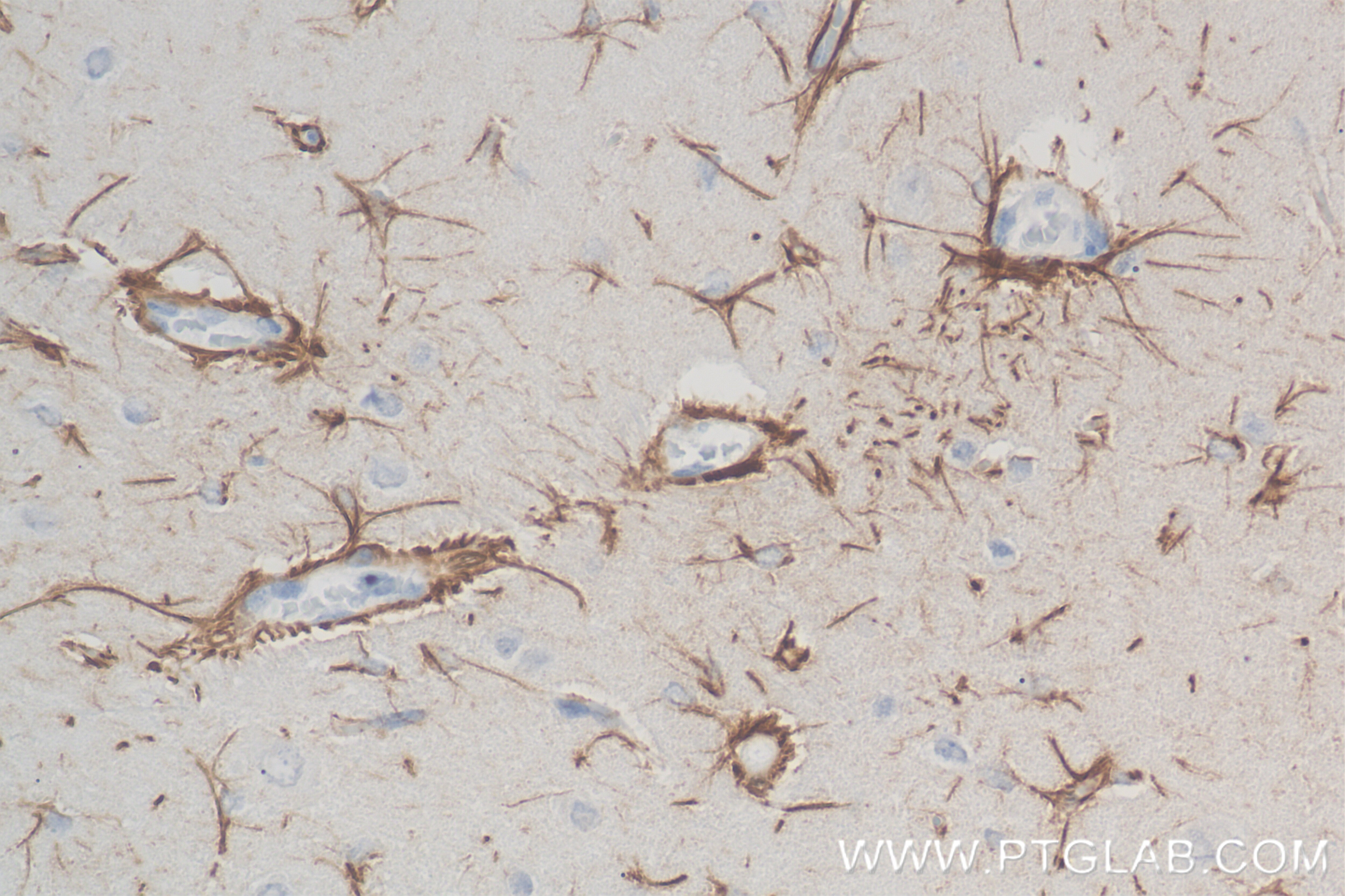 Immunohistochemistry (IHC) staining of rat brain tissue using TRAF6 Recombinant antibody (83535-2-RR)