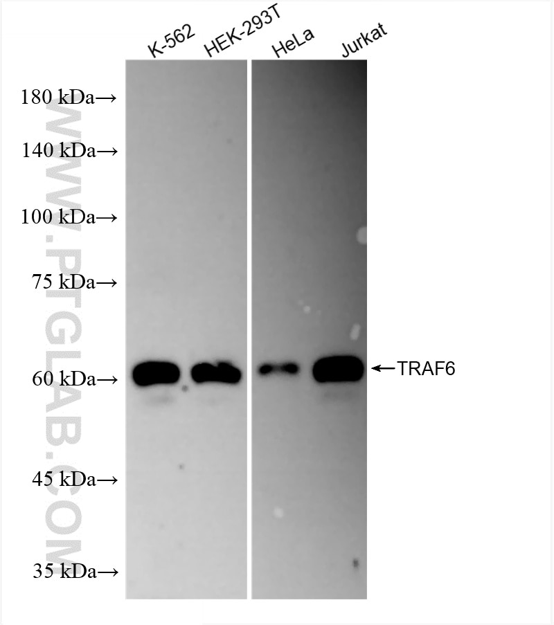 Western Blot (WB) analysis of various lysates using TRAF6 Recombinant antibody (83535-2-RR)