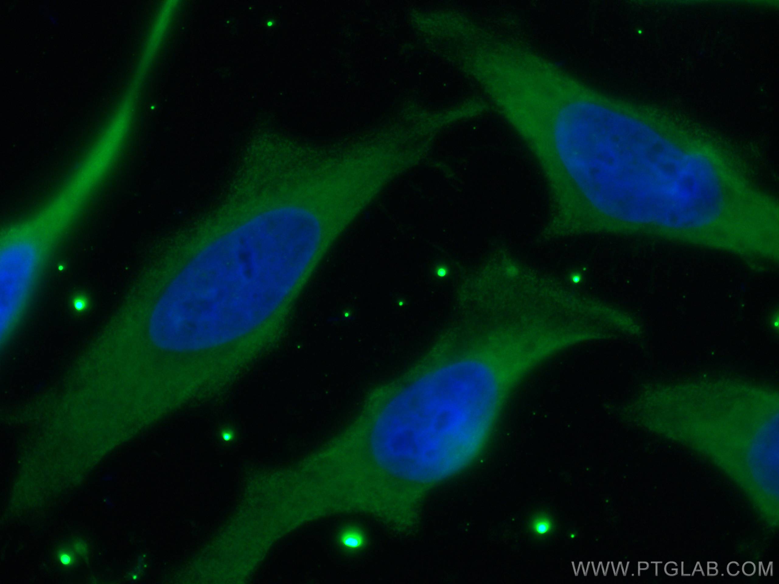 Immunofluorescence (IF) / fluorescent staining of HeLa cells using CoraLite® Plus 488-conjugated TRAF6 Monoclonal ant (CL488-66498)
