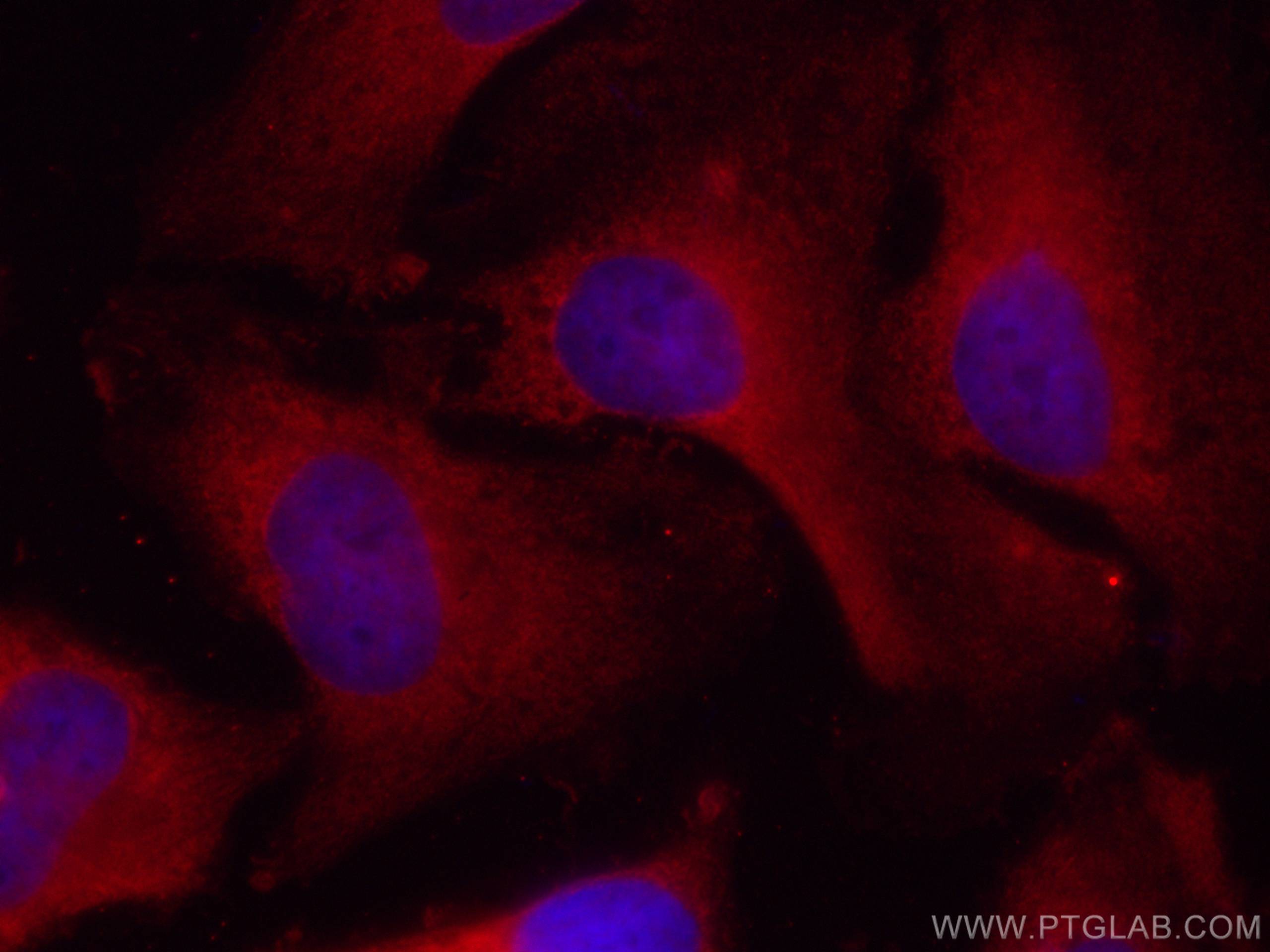 Immunofluorescence (IF) / fluorescent staining of HeLa cells using CoraLite®594-conjugated TRAF6 Monoclonal antibody (CL594-66498)