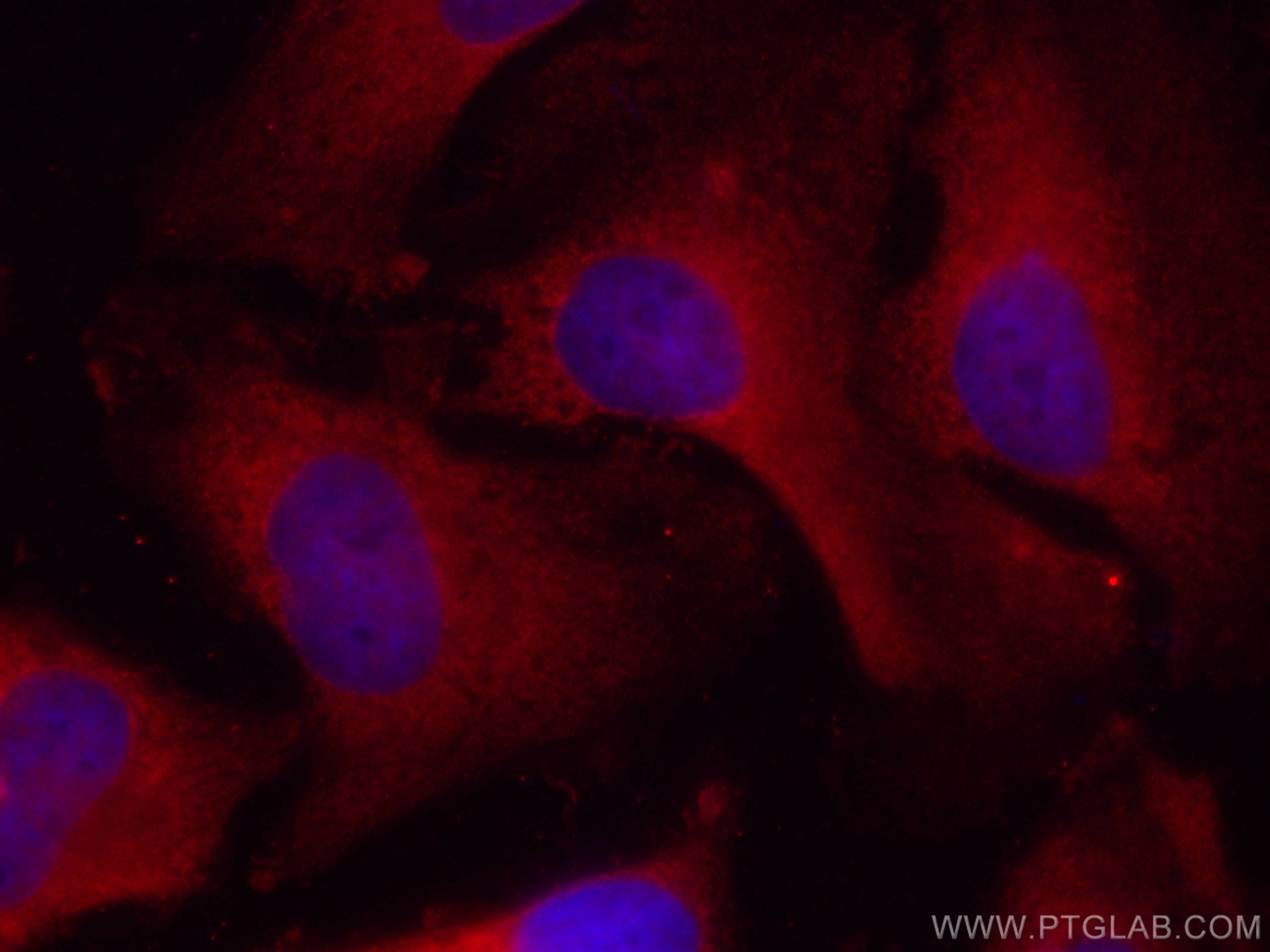 IF Staining of HeLa using CL594-66498