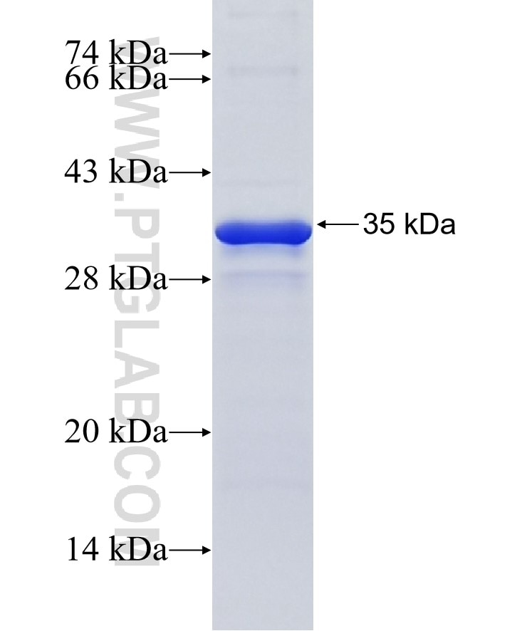 TRAF6 fusion protein Ag14858 SDS-PAGE