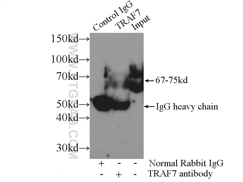 Immunoprecipitation (IP) experiment of mouse liver tissue using TRAF7 Polyclonal antibody (11780-1-AP)