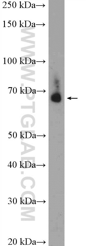 Western Blot (WB) analysis of mouse heart tissue using TRAF7 Polyclonal antibody (11780-1-AP)