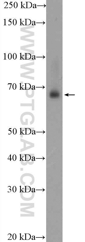 Western Blot (WB) analysis of rat heart tissue using TRAF7 Polyclonal antibody (11780-1-AP)