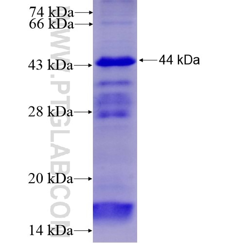 TRAF7 fusion protein Ag15273 SDS-PAGE TRAF7 fusion protein Ag15273 SDS-PAGE