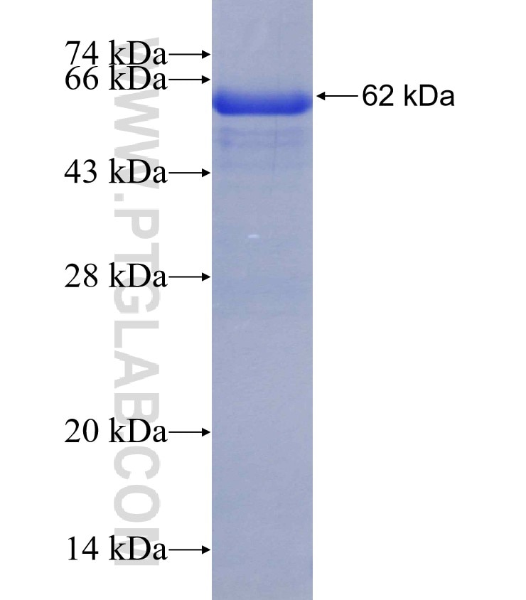 TRAF7 fusion protein Ag2414 SDS-PAGE