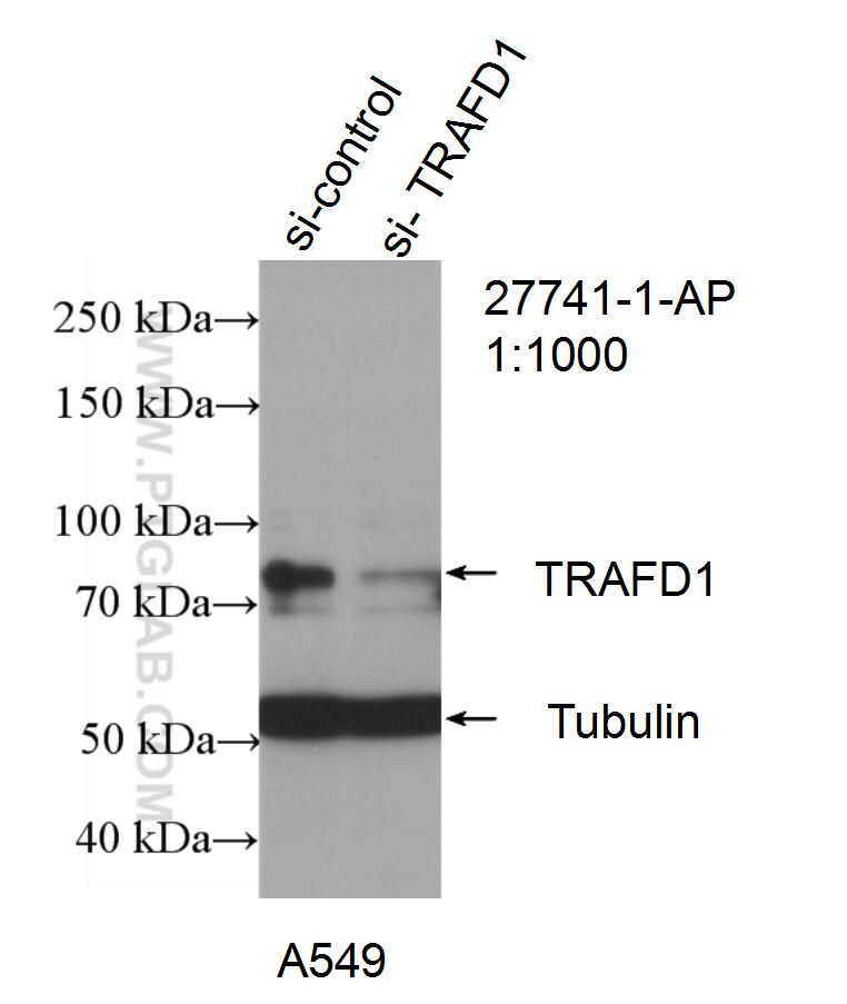 Western Blot (WB) analysis of A549 cells using TRAFD1 Polyclonal antibody (27741-1-AP)