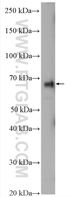 Western Blot (WB) analysis of HeLa cells using TRAFD1 Polyclonal antibody (27741-1-AP)
