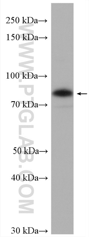 Western Blot (WB) analysis of HEK-293 cells using TRAFD1 Polyclonal antibody (27741-1-AP)