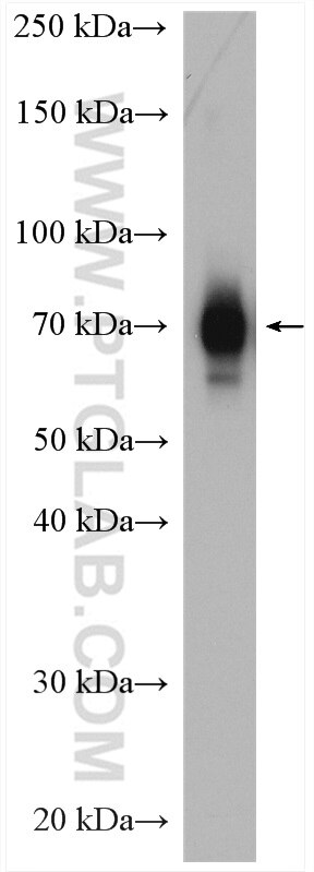 Western Blot (WB) analysis of K-562 cells using TRAFD1 Polyclonal antibody (27741-1-AP)