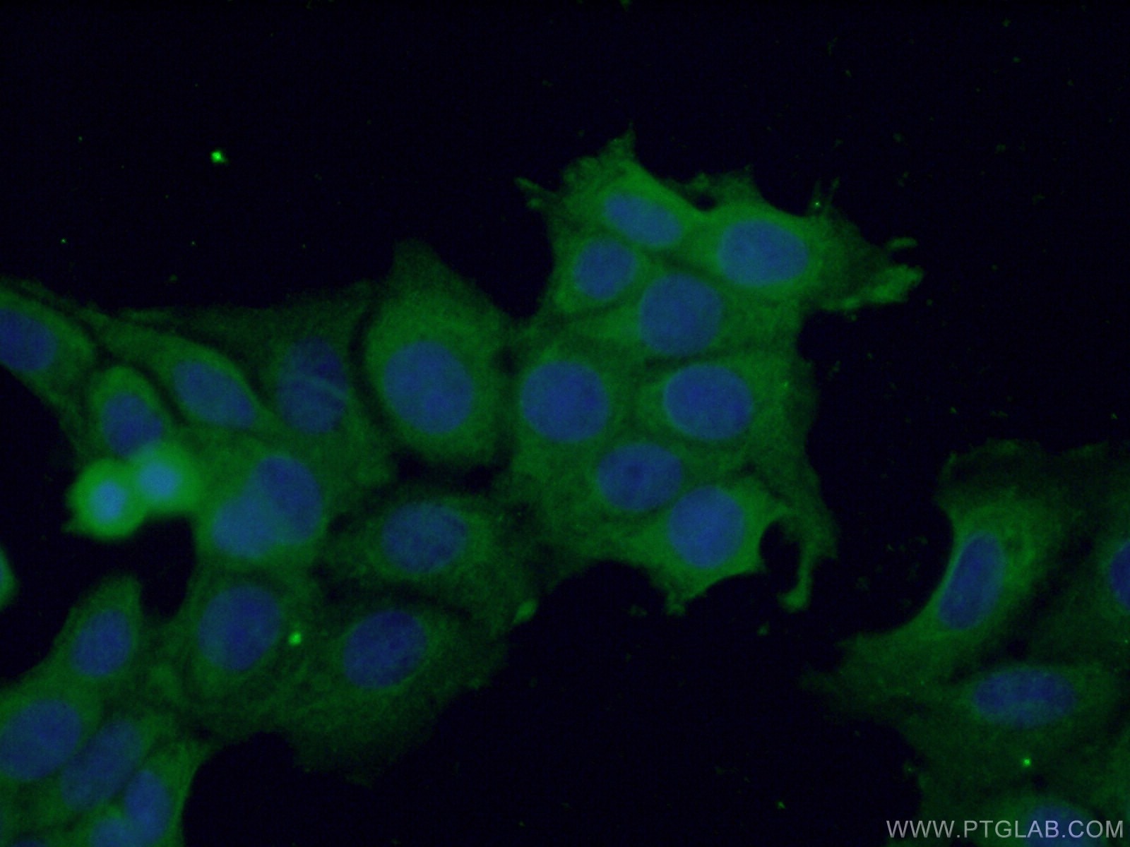 Immunofluorescence (IF) / fluorescent staining of MCF-7 cells using TRAIL Polyclonal antibody (27064-1-AP)