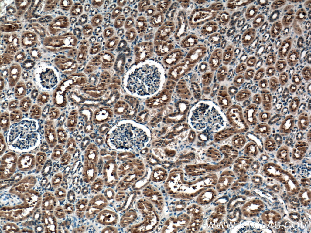 Immunohistochemistry (IHC) staining of human kidney tissue using TRAIL Polyclonal antibody (27064-1-AP)