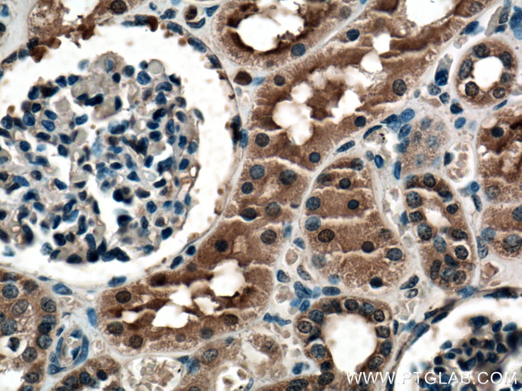 Immunohistochemistry (IHC) staining of human kidney tissue using TRAIL Polyclonal antibody (27064-1-AP)