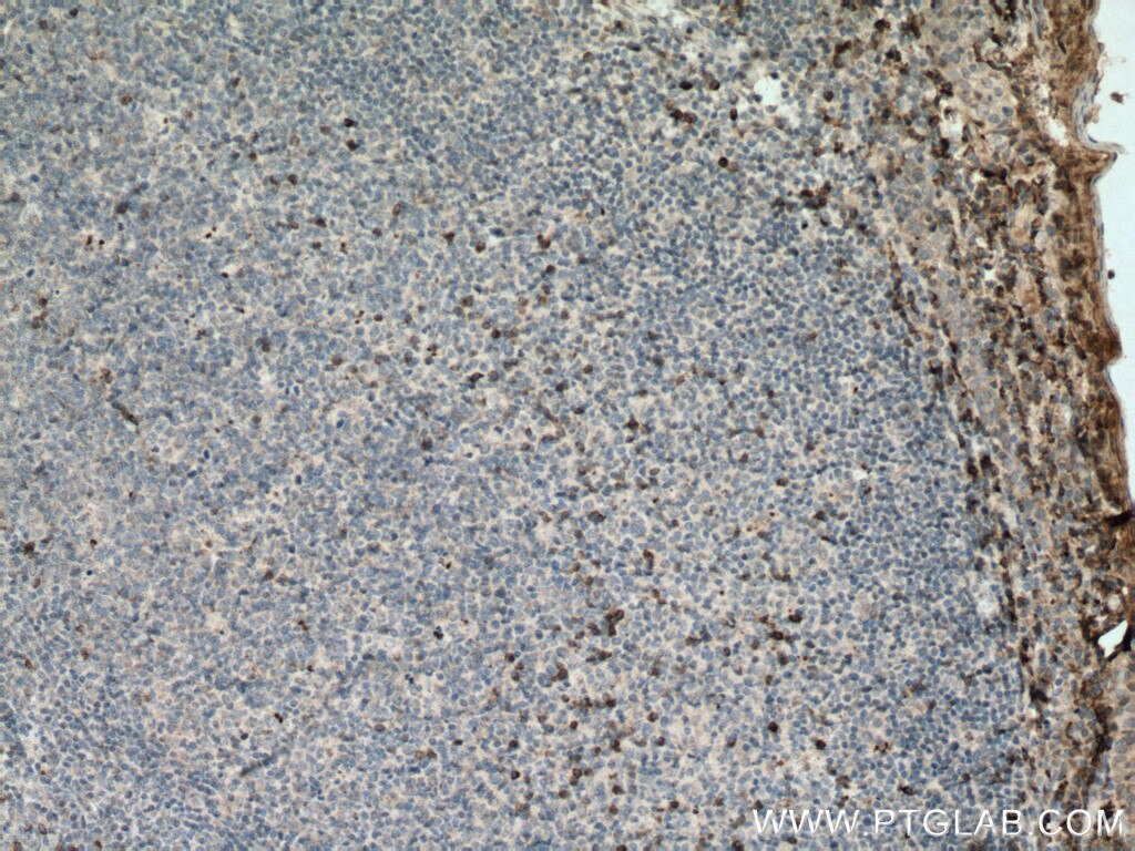 Immunohistochemistry (IHC) staining of human tonsillitis tissue using TRAIL Monoclonal antibody (66756-1-Ig)