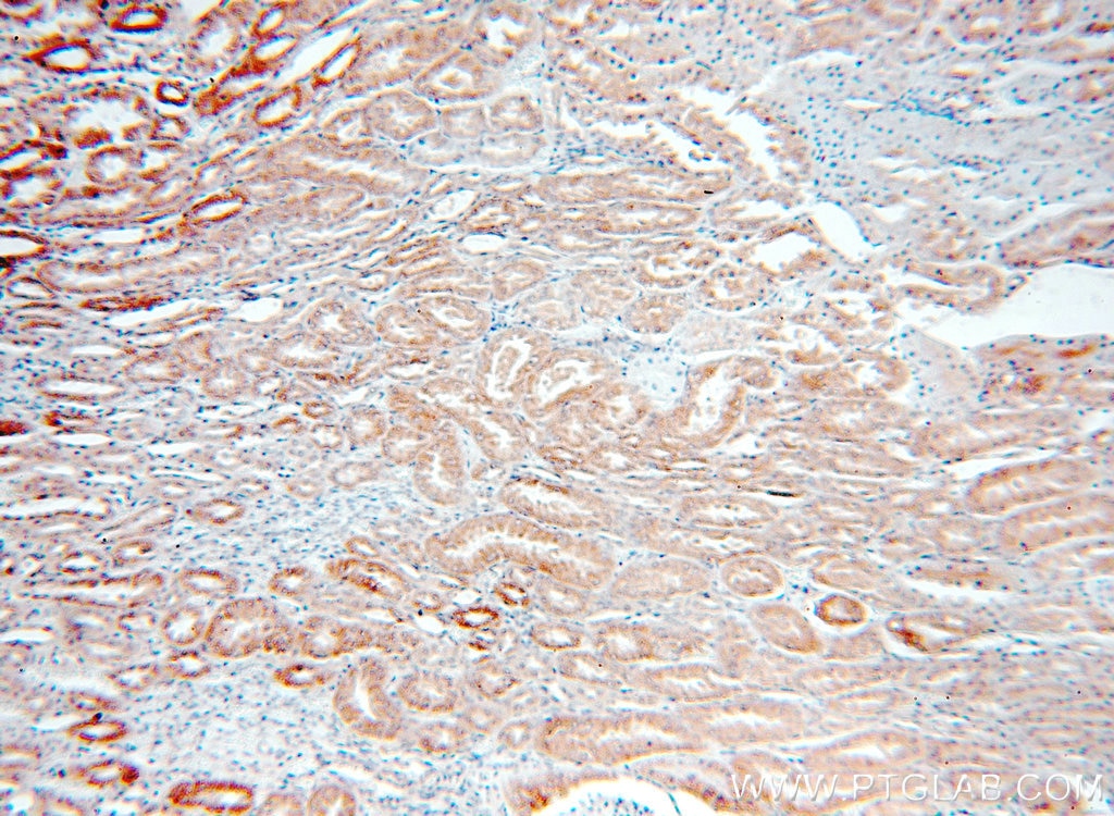 Immunohistochemistry (IHC) staining of human kidney tissue using DcR2 Polyclonal antibody (16781-1-AP)