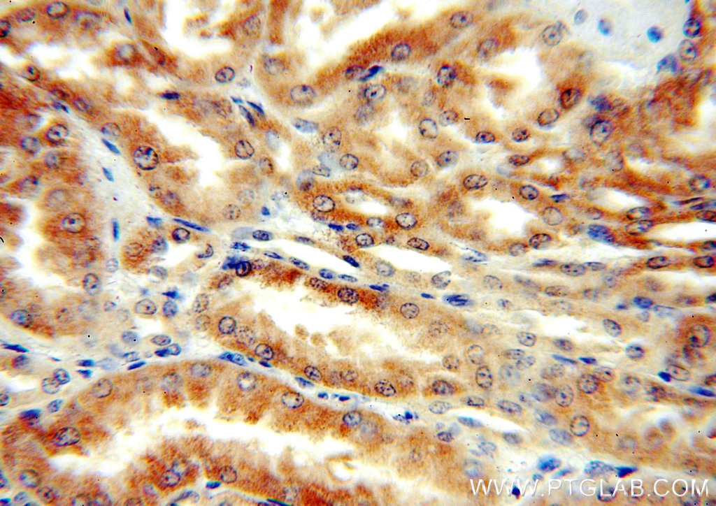 Immunohistochemistry (IHC) staining of human kidney tissue using DcR2 Polyclonal antibody (16781-1-AP)