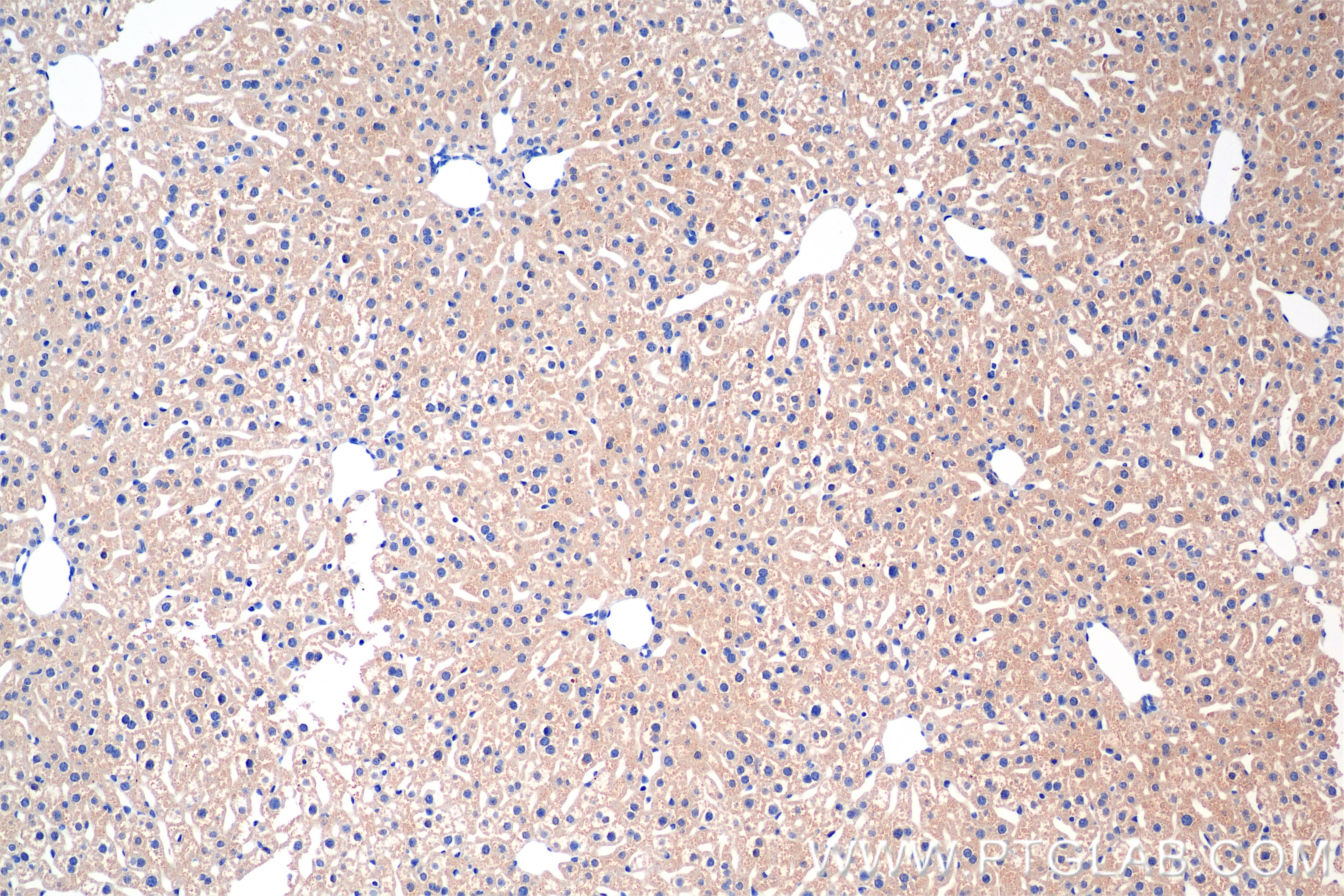 Immunohistochemistry (IHC) staining of mouse liver tissue using DcR2 Recombinant antibody (85425-2-RR)